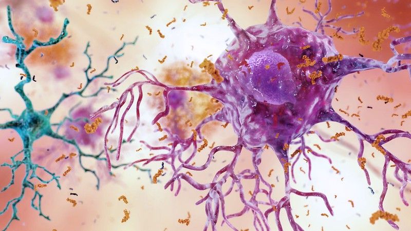 The PLX dataset: what is the role of microglia in dementia risk?